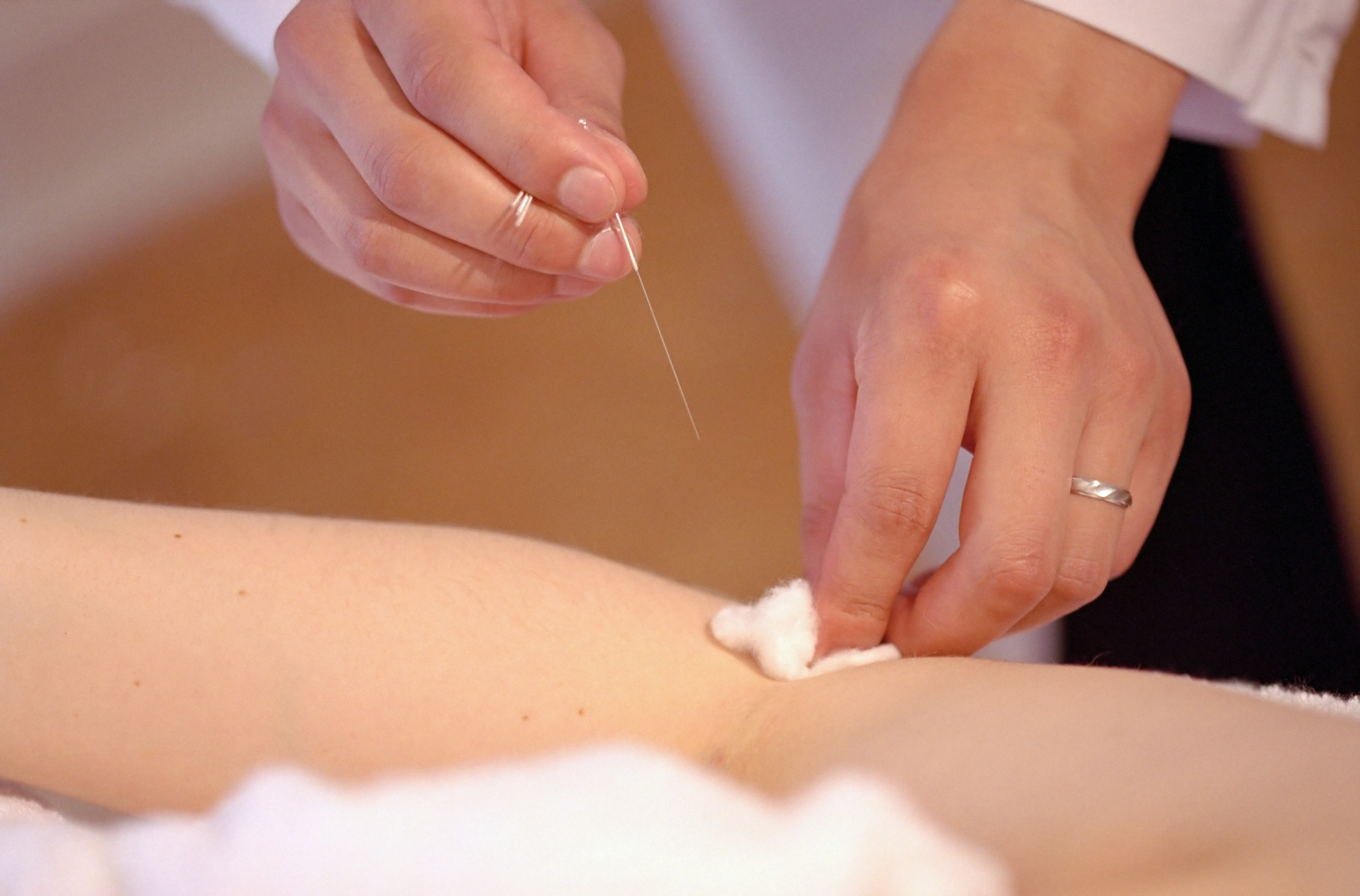 针灸